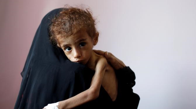 الأمم المتحدة: 50 ألف يمني يعيشون ظروفًا شبيهة بالمجاعة