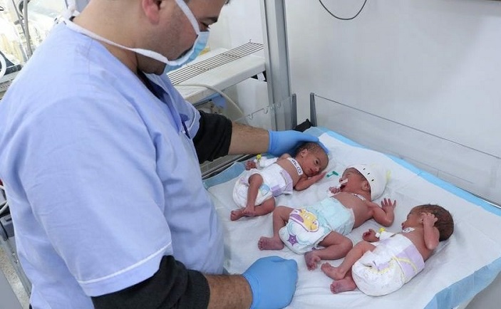 ولادة توأم ثلاثي بصحة جيدة في إدلب