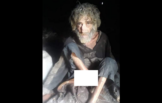عبدالله.. صورة رجل يجسد حال سوريا تحت حكم الأسد.. فما القصة؟